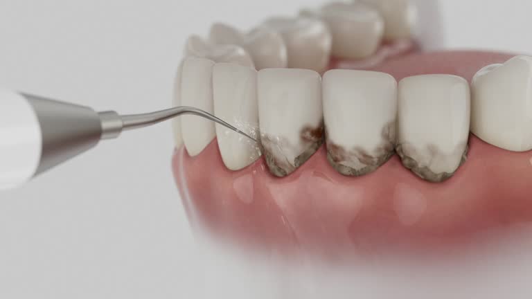 Reliable Dental Implants contractor in Sneads Ferry, NC by Smile Center Dentistry